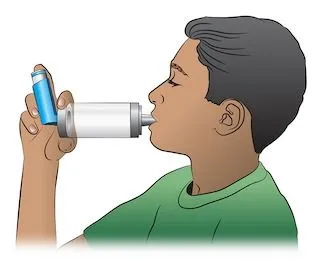 <strong>
</picture>How to Use a MDI with Spacer</strong> <p>A <strong>spacer</strong> (or holding chamber) can be useful for all people with asthma. A spacer makes it easier to correctly inhale the asthma medicine from the metered dose inhaler (MDI). A spacer is very useful in younger children and older adults.</p><ul><li>STEP 1 - Shake the inhaler and then attach it to the spacer (holding chamber).</li><li>STEP 2 - Breathe out completely.</li><li>STEP 3 - Place the mouthpiece of the spacer in your mouth. </li><li>STEP 4 - Press down on the inhaler. This will put one puff of the medicine in the holding chamber or spacer.</li><li>STEP 5 - Breathe in slowly for 5 seconds.</li><li>STEP 6 - Hold your breath for 10 seconds and then exhale.</li><li>If your doctor has prescribed two or more puffs, wait 1 minute between each puff and then repeat steps 1-6.</li></ul>