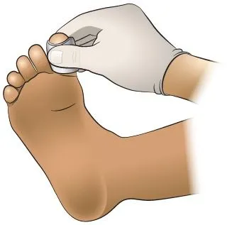 <strong>
</picture>First Aid - Bleeding Toe</strong> <ul><li>Apply direct pressure to the entire wound with a sterile gauze dressing or a clean cloth.</li></ul>