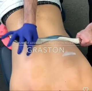 graston technique