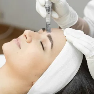 Microdermabrasion