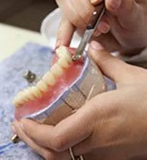 process of making dentures Frederick, MD