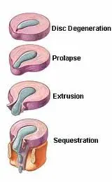 disc_phases.jpg