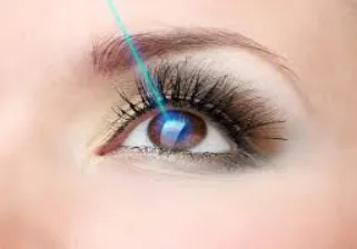 Laser eye surgery graphic image