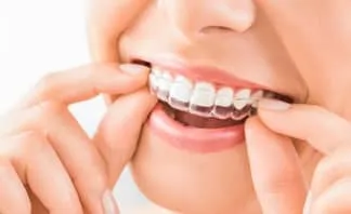 hand holding clear teeth aligners in mouth, Invisalign Millbrae, CA 