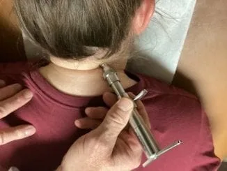 Instrument adjusting torque release technique chiropractic