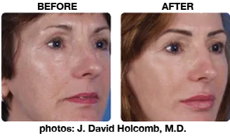 Fabulously SLIM - Dermacare Face Body and Laser Center