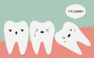 cartoon illustration of wisdom teeth impacted, Fountain Valley, CA tooth extractions
