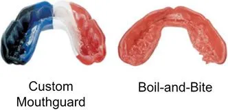 Custom Mouthguard