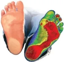 digital_foot_scan_1_.jpg