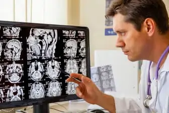 Chiropractor analyzing imaging of the brain