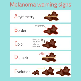 Melanoma Warning Signs