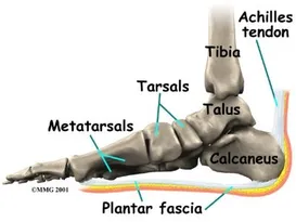 Plantar Fasciitis: The Achilles Heel of Foot and Ankle Surgeons: Eugene  Stautberg, MD: General Orthopedic Surgeon