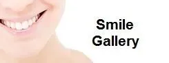 smile_gallery_button.jpg