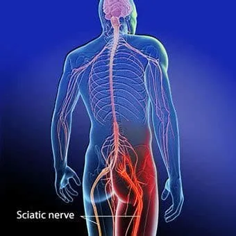 Sciatic Nerve Pain Relief at Night - Healthcare Associates of Texas