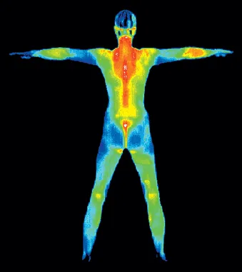 thermography