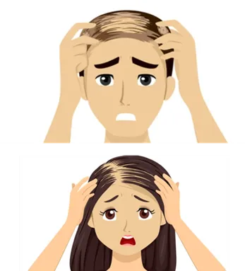 Alopecia Graphic image