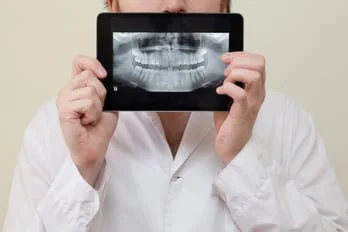 Choose Romano Dental for X-Rays, Dentist Bridgeport