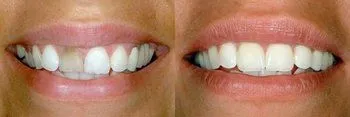 <p>Instant Dental Care</p> in El Cajon CA