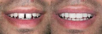 <p>Instant Dental Care</p> in El Cajon CA