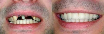 <p>Instant Dental Care</p> in El Cajon CA
