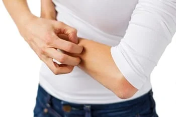 Eczema - Itchy Skin