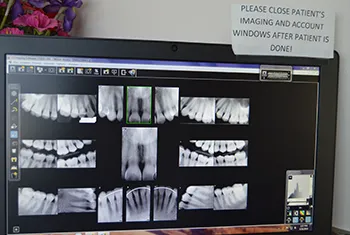 Digital X-Ray