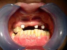 Lincoln Park, IL Dentist
