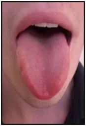 iso_tongue.jpg