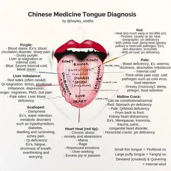 acupuncture-tongue-diagnosis