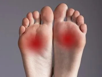 Illustration of foot neuroma pain on a person with red highlights