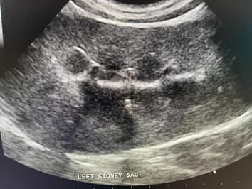 Ultrasound picture 