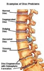 spine_injury_pic.jpg