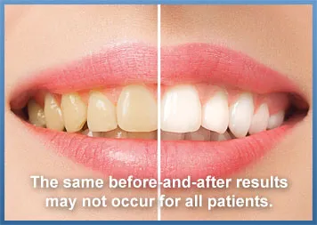 Cosmetic Dentistry - Dentist Fullerton, CA | Eric Meyer, DDS