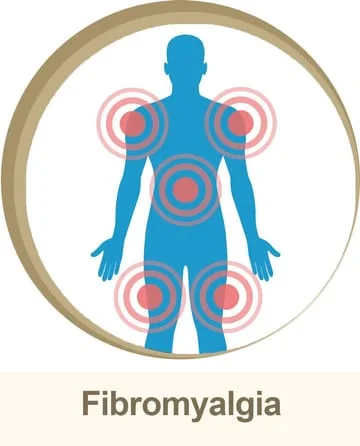 fibromyalgia