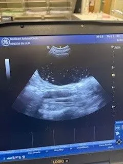 ultrasound