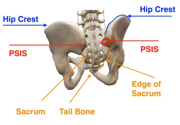 5 Sacroiliac Joint Pain Symptoms