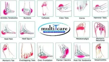 Foot Pain Conditions