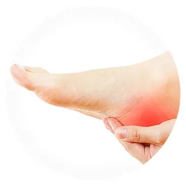 plantar heel pain plantar fasciitis