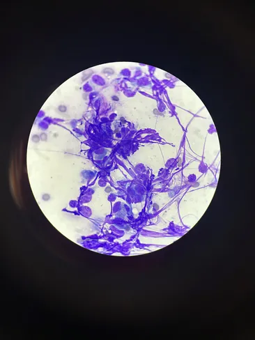 cytology