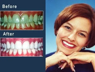 alabama dentist gold medal smile design