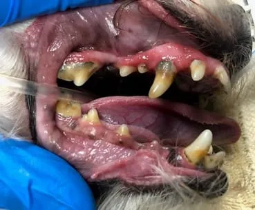 severe tartar on teeth