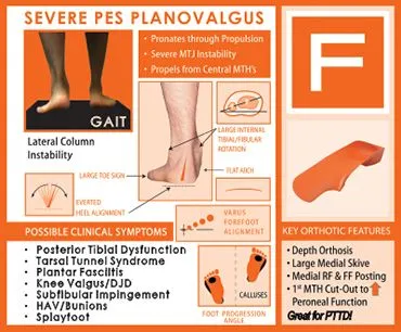 F Quad Foot Type