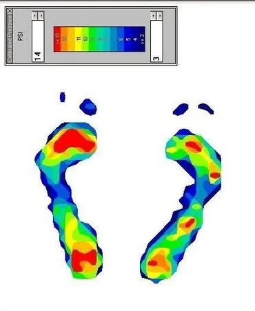 Baton Rouge Podiatrist | Baton Rouge Dynamic Gait and Pressure Load Analysis | LA | Foot And Ankle Institute |
