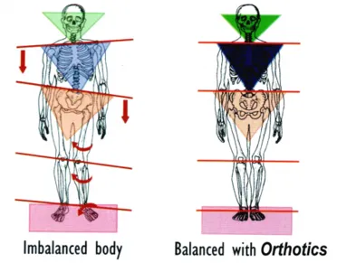 Imbalanced and Balanced