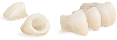 illustration of loose dental crowns Lincoln, NE