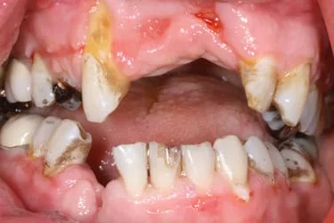 Dental trauma pre treatment