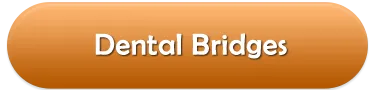 Dental Bridges