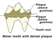 toothillustration.jpg