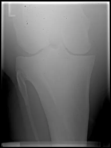 x-ray image