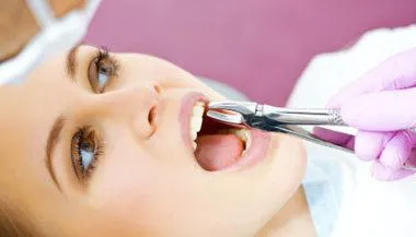 woman getting tooth extracted with dental tools, tooth extractions Farmingdale, NY dentist